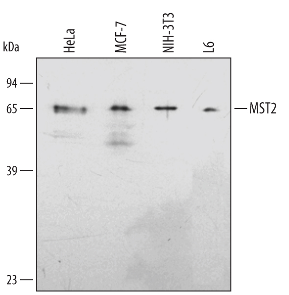 Western blot shows lysates of HeLa human cervical epithelial carcinoma cell line, MCF-7 human breast cancer cell line, NIH-3T3 mouse embryonic fibroblast cell line, and L6 rat myoblast cell line. PVDF membrane was probed with 1 µg/mL of Human/Mouse/Rat MST2/STK3 Antigen Affinity-purified Polyclonal Antibody (Catalog # AF4549) followed by HRP-conjugated Anti-Goat IgG Secondary Antibody (Catalog # HAF017). A specific band was detected for MST2/STK3 at approximately 65 kDa (as indicated). This experiment was conducted under reducing conditions and using Immunoblot Buffer Group 2.