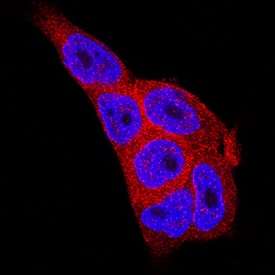 MST2/STK3 was detected in immersion fixed A431 human epithelial carcinoma cell line using Rabbit Anti-Human MST2/STK3 Monoclonal Antibody (Catalog # MAB4549) at 3 µg/mL for 3 hours at room temperature. Cells were stained using the NorthernLights™ 557-conjugated Anti-Rabbit IgG Secondary Antibody (red; Catalog # NL004) and counterstained with DAPI (blue). Specific staining was localized to cytoplasm and nuclei. View our protocol for Fluorescent ICC Staining of Cells on Coverslips.