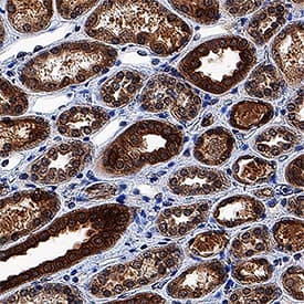         MST2/STK3  was detected in immersion fixed paraffin-embedded sections of human kidney  using Rabbit Anti-Human/Mouse/Rat MST2/STK3 Monoclonal Antibody (Catalog #  MAB4549) at 0.3 µg/mL for 1 hour at room temperature  followed by incubation with the Anti-Rabbit IgG VisUCyte™ HRP  Polymer Antibody (Catalog # VC003).  Tissue was stained using DAB (brown) and counterstained with hematoxylin  (blue).  Specific staining was  localized to cytoplasm and nuclei in epithelial cells in convoluted tubules.  View our protocol for IHC  Staining with VisUCyte HRP Polymer Detection Reagents.  