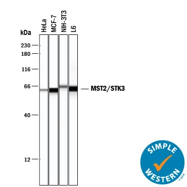     Simple  Western lane view shows lysates of HeLa human cervical epithelial carcinoma  cell line, MCF‑7 human breast cancer cell line, NIH‑3T3  mouse embryonic fibroblast cell line, and L6 rat myoblast cell line, loaded  at 0.2 mg/mL. A specific band was detected for MST2/STK3 at  approximately 62-64 kDa (as indicated) using 1 µg/mL of  Rabbit Anti-Human/Mouse/Rat MST2/STK3 Monoclonal Antibody (Catalog # MAB4549)  . This experiment was conducted under reducing conditions and using the  12-230 kDa separation system.         