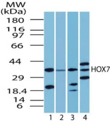 Western Blot: MSX1 Antibody [NBP2-24715] - Analysis of human HOX7 in human liver lysate in the 1) absence, 2) presence of immunizing peptide, 3) mouse and 4) rat liver using NBP2-24715 at 2 ug/ml.