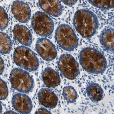 Immunohistochemistry-Paraffin: MUC5B Antibody [NBP1-92151] - Staining of human lower gastrointestinal shows strong extracellular space positivity in glandular cells.