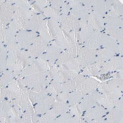 Immunohistochemistry-Paraffin: MUC5B Antibody [NBP1-92151] - Staining of human skeletal muscle shows no positivity in myocytes as expected.