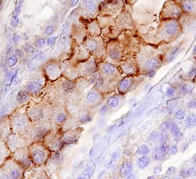 MUCDHL was detected in immersion fixed paraffin-embedded sections of human kidney using 15 µg/mL Goat Anti-Human MUCDHL Antigen Affinity-purified Polyclonal Antibody (Catalog # AF3826) overnight at 4 °C. Tissue was stained with the Anti-Goat HRP-DAB Cell & Tissue Staining Kit (brown; Catalog # CTS008) and counterstained with hematoxylin (blue). Specific labeling was localized to the plasma membrane of epithelial cells in collecting tubules. View our protocol for Chromogenic IHC Staining of Paraffin-embedded Tissue Sections.