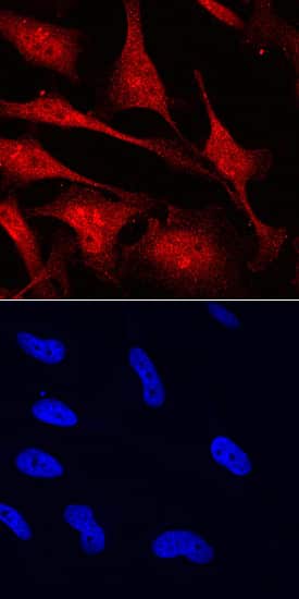 MYCL1/L-Myc was detected in immersion fixed HeLa human cervical epithelial carcinoma cell line using Goat Anti-Human/Mouse MYCL1/L-Myc Antigen Affinity-purified Polyclonal Antibody (Catalog # AF4050) at 10 µg/mL for 3 hours at room temperature. Cells were stained using the NorthernLights™ 557-conjugated Anti-Goat IgG Secondary Antibody (red, upper panel; Catalog # NL001) and counterstained with DAPI (blue, blue panel). Specific staining was localized to cytoplasm and nuclei. View our protocol for Fluorescent ICC Staining of Cells on Coverslips.