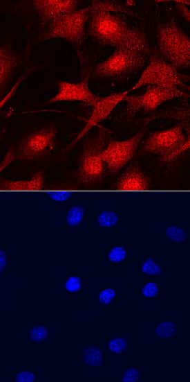 MYCL1/L-Myc was detected in immersion fixed NIH3T3 mouse embryonic fibroblast cell line using Goat Anti-Human/Mouse MYCL1/L-Myc Antigen Affinity-purified Polyclonal Antibody (Catalog # AF4050) at 10 µg/mL for 3 hours at room temperature. Cells were stained using the Northern-Lights™ 557-conjugated Anti-Goat IgG Secondary Antibody (red, upper panel; Catalog # NL001) and counterstained with DAPI (blue, lower panel). Specific staining was localized to cytoplasm and nuclei. View our protocol for Fluorescent ICC Staining of Cells on Coverslips.