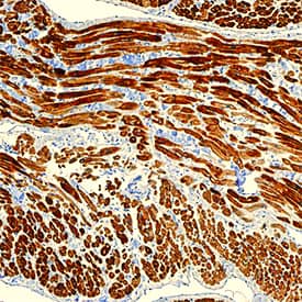 MYH6 was detected in immersion fixed paraffin-embedded sections of human heart using Mouse Anti-Human MYH6 Monoclonal Antibody (Catalog # MAB8979) at 5 µg/mL overnight at 4 °C. Tissue was stained using the Anti-Mouse HRP-DAB Cell & Tissue Staining Kit (brown; CTS002) and counterstained with hematoxylin (blue). Specific staining was localized to cytoplasm of cardiomyocytes. View our protocol for Chromogenic IHC Staining of Paraffin-embedded Tissue Sections.