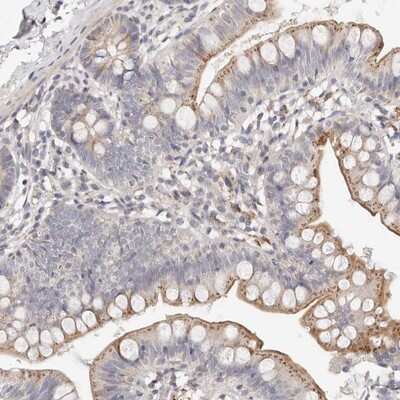 Myom3 Antibody Nbp1 81960 Novus Biologicals