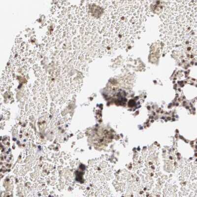 Immunohistochemistry-Paraffin: Mad Antibody [NBP1-89979] - Staining of human bone marrow shows high expression.