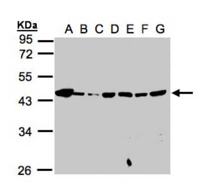 Mannose Phosphate Isomerase Antibody (nbp1-31460): Novus Biologicals