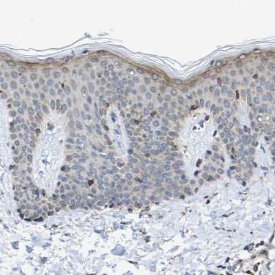 Immunohistochemistry-Paraffin: Map17 Antibody [NBP1-84290] - Staining of human skin shows weak membranous and cytoplasmic positivity in superficial layer of squamous epithelial cells.