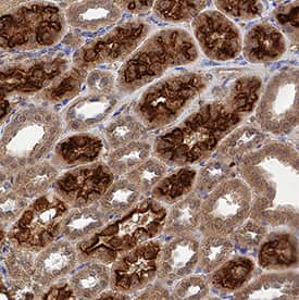     Megalin/LRP2  was detected in immersion fixed paraffin-embedded sections of human kidney  using Mouse Anti-Human Megalin/LRP2 Monoclonal Antibody (Catalog # MAB9578)  at 5 µg/mL for 1 hour at room temperature followed by  incubation with the Anti-Mouse IgG VisUCyte™  HRP Polymer Antibody (Catalog #  VC001).  Tissue was stained using DAB (brown) and counterstained with hematoxylin  (blue).  Specific staining was  localized to convoluted tubules. View our protocol for IHC  Staining with VisUCyte HRP Polymer Detection Reagents. 