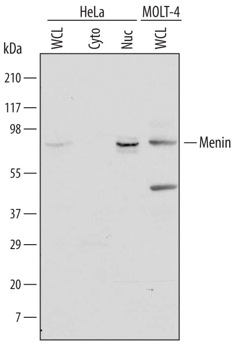 Western blot shows lysates of HeLa human cervical epithelial carcinoma cell line and MOLT-4 human acute lymphoblastic leukemia cell line. Gels were loaded with 30 µg of whole cell lysate (WCL), 20 µg of cytoplasmic (Cyto), and 10 µg of nuclear extracts (Nuc). PVDF Membrane was probed with 2 µg/mL of Goat Anti-Human Menin Antigen Affinity-purified Polyclonal Antibody (Catalog # AF6005) followed by HRP-conjugated Anti-Goat IgG Secondary Antibody (Catalog # HAF017). A specific band was detected for Menin at approximately 90 kDa (as indicated). This experiment was conducted under reducing conditions and using Immunoblot Buffer Group 1.