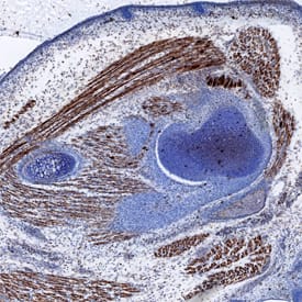 Meteorin-like/METRNL was detected in immersion fixed frozen sections of mouse embryo (13 d.p.c.) using Sheep Anti-Mouse Meteorin-like/METRNL Antigen Affinity-purified Polyclonal Antibody (Catalog # AF6679) at 0.6 µg/mL overnight at 4 °C. Tissue was stained using the Anti-Sheep HRP-DAB Cell & Tissue Staining Kit (brown; Catalog # CTS019) and counterstained with hematoxylin (blue). Specific staining was localized to muscle cells. View our protocol for Chromogenic IHC Staining of Frozen Tissue Sections.
