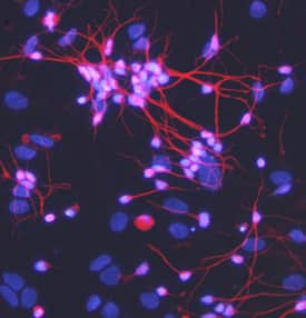 Immunocytochemistry Meteorin Antibody (347505)