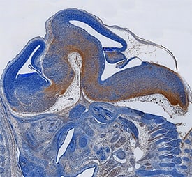 Meteorin-like/METRNL was detected in immersion fixed frozen sections of mouse embryo (15 d.p.c.) using Rat Anti-Mouse Meteorin-like/METRNL Monoclonal Antibody (Catalog # MAB6679) at 25 µg/mL overnight at 4 °C. Tissue was stained using the Anti-Rat HRP-DAB Cell & Tissue Staining Kit (brown; Catalog # CTS017) and counterstained with hematoxylin (blue). Specific staining was localized to developing CNS. View our protocol for Chromogenic IHC Staining of Frozen Tissue Sections.