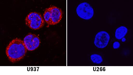 Immunocytochemistry Meteorin-like/METRNL Antibody (2441D) [Unconjugated]