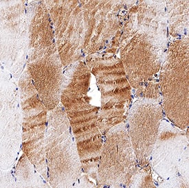   Meteorin‑like/METRNL  was detected in immersion fixed paraffin-embedded sections of human skeletal  muscle using Rabbit Anti-Human Meteorin‑like/METRNL Monoclonal  Antibody (Catalog # MAB78672) at 3 µg/mL for 1 hour at  room temperature followed by incubation with the Anti-Rabbit IgG  VisUCyte™ HRP Polymer Antibody (Catalog # VC003).  Before incubation with the primary antibody, tissue was subjected to  heat-induced epitope retrieval using Antigen Retrieval Reagent-Basic (Catalog  # CTS013).  Tissue was stained using DAB (brown) and counterstained with hematoxylin  (blue). Specific staining was localized to sarcoplasm. View our protocol for  IHC  Staining with VisUCyte HRP Polymer Detection Reagents.