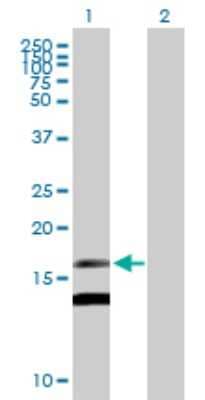 Midkine Antibody (H00004192-B02P): Novus Biologicals