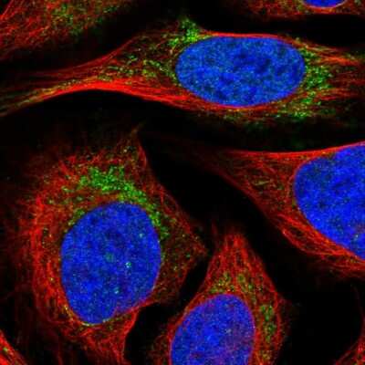 Mitocondrial Translational Initiation Factor 3 Antibody (NBP1-92121 ...