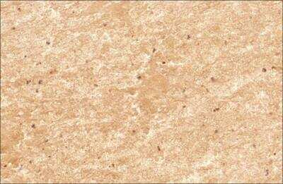 Immunohistochemistry-Paraffin: Mitofusin 2 Antibody [NBP2-66383] - Analysis of FFPE tissue section of mouse heart using Mitofusin 2/MFN2 antibody at 5 ug/mL concentration (1:200 dilution). The primary antibody binding to MFN2 antigen was detected using HRP conjugated anti-rabbit secondary antibody with DAB reagent, and the sections were further counterstained with hematoxylin for labeling cellular nuclei. This MFN2 antibody generated a diffused to punctate cytoplasmic staining of mitochondria in the cardiac muscles (brown color). The nuclei of the muscle cells and the macrophages are stained blue in this image (40X image of a transverse section of heart tissue).