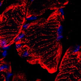 Mitofusin 2 was detected in perfusion fixed frozen sections of mouse skeletal muscle using Sheep Anti-Human/Mouse/Rat Mitofusin 2 Antigen Affinity-purified Polyclonal Antibody (Catalog # AF7884) at 1.7 µg/mL overnight at 4 °C. Tissue was stained using the NorthernLights™ 557-conjugated Anti-Sheep IgG Secondary Antibody (red; Catalog # NL010) and counterstained with DAPI (blue). Specific staining was localized to cytoplasm. View our protocol for Fluorescent IHC Staining of Frozen Tissue Sections. 