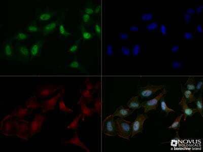 Immunocytochemistry/Immunofluorescence: Mre11 Antibody [NB100-142] - HeLa cells were fixed for 10 minutes using 10% formalin and then permeabilized for 5 minutes using 1X TBS + 0.5% Triton X-100. The cells were incubated with anti-Mre11 [NB100-142] at a 1:500 dilution overnight at 4C and detected with an anti-rabbit DyLight 488 (Green) at a 1:500 dilution. Actin was detected with Phalloidin 568 (Red) at a 1:200 dilution.  Nuclei were counterstained with DAPI (Blue). Cells were imaged using a 40X objective.