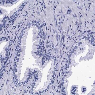 Immunohistochemistry-Paraffin: MyBPC3 Antibody [NBP2-13631] - Staining of human prostate shows no positivity in smooth muscle cells or glandular cells as expected.