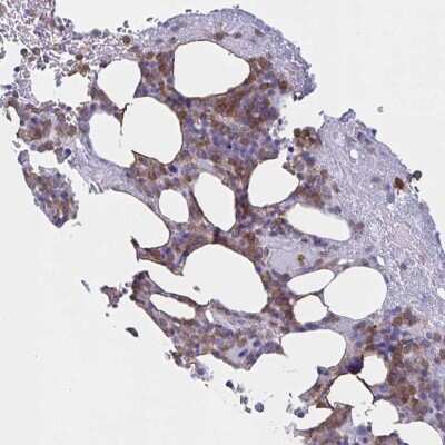 Immunohistochemistry: Myosin IF Antibody [NBP2-31598] - Staining of human bone marrow shows moderate cytoplasmic positivity in hematopoietic cells.