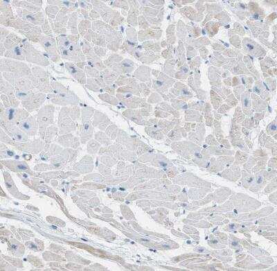 Myosin heavy chain 11 Antibody (NBP1-87025): Novus Biologicals