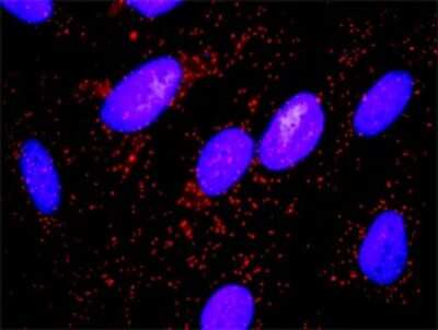 Myosin Light Chain Kinase Antibody Cell Signaling Pathway | Shelly Lighting