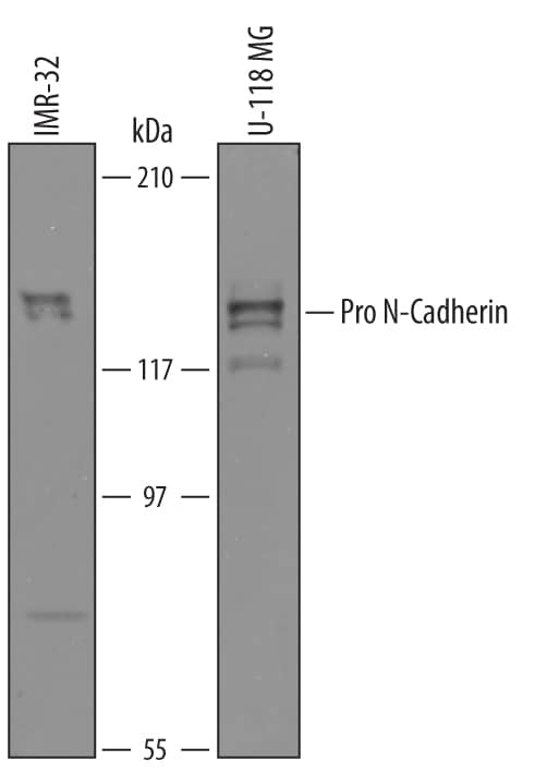 Western blot shows lysates of IMR‑32 human neuroblastoma cell line and U‑118‑MG human glioblastoma/astrocytoma cell line. PVDF membrane was probed with 1 µg/mL of Sheep Anti-Human N‑Cadherin Propeptide Antigen Affinity-purified Polyclonal Antibody (Catalog # AF1388) followed by HRP-conjugated Anti-Sheep IgG Secondary Antibody (Catalog # HAF016). Pro-N-Cadherin was detected at approximately 130 kDa (as indicated). This experiment was conducted under reducing conditions and using Immunoblot Buffer Group 8.