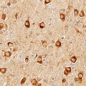 N-Cadherin was detected in immersion fixed paraffin-embedded sections of Alzheimer's human brain using Mouse Anti-Human N-Cadherin Monoclonal Antibody (Catalog # MAB13881) at 15 µg/mL overnight at 4 °C. Before incubation with the primary antibody, tissue was subjected to heat-induced epitope retrieval using Antigen Retrieval Reagent-Basic (Catalog # CTS013). Tissue was stained using the Anti-Mouse HRP-DAB Cell & Tissue Staining Kit (brown; Catalog # CTS002) and counterstained with hematoxylin (blue). Specific staining was localized to cytoplasm of neurons. View our protocol for Chromogenic IHC Staining of Paraffin-embedded Tissue Sections.