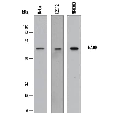 Western blot shows lysates of HeLa human cervical epithelial carcinoma cell line, C2C12 mouse myoblast cell line, and NR8383 rat alveolar macrophage cell line. PVDF membrane was probed with 2 µg/mL of Sheep Anti-Human/Mouse/Rat NADK Antigen Affinity-purified Polyclonal Antibody (Catalog # AF8009) followed by HRP-conjugated Anti-Sheep IgG Secondary Antibody (Catalog # HAF016). A specific band was detected for NADK at approximately 50-55 kDa (as indicated). This experiment was conducted under reducing conditions and using Immunoblot Buffer Group 1.