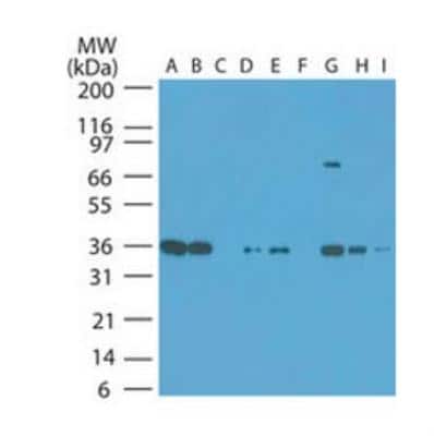 Western Blot: PBEF/Visfatin/NAMPT Antibody [NBP2-23795] - NAMPT Antibody [NBP2-23795] - Analysis of NAMPT in human tumor cell line INSTA-Blot at 1:1000. Lanes: (A) HeLa, (B) Jurkat, (C) Daudi, (D) HEK 293, (E) Rh30, (F) A375, (G) T98G, (H) HCT-116, (I) Hep-2.
