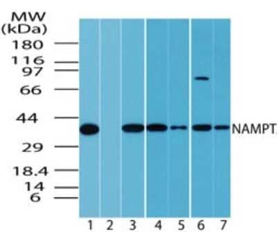 Western Blot: PBEF/Visfatin/NAMPT Antibody [NBP2-23795] - NAMPT Antibody [NBP2-23795] - Western blot analysis of NAMPT in multiple samples using NBP2-23795 at 1:1000. Lanes: (1) Human spleen, (2) Human spleen in the presence of immunizing/blocking peptide, (3) HeLa, (4) Jurkat, (5) Rh30, (6) T98G, (7) HCT-116.