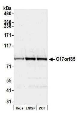 NCBP3 Antibody (NBP2-76816): Novus Biologicals