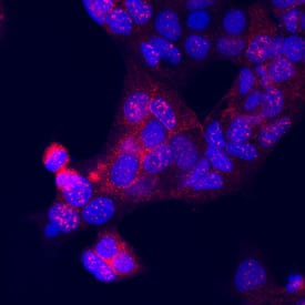 NCK1 was detected in immersion fixed MCF-7 human breast cancer cell line using Mouse Anti-Human NCK1 Monoclonal Antibody (Catalog # MAB7008) at 25 µg/mL for 3 hours at room temperature. Cells were stained using the NorthernLights™ 557-conjugated Anti-Mouse IgG Secondary Antibody (red; Catalog # NL007) and counterstained with DAPI (blue). Specific staining was localized to cytoplasm. View our protocol for Fluorescent ICC Staining of Cells on Coverslips.