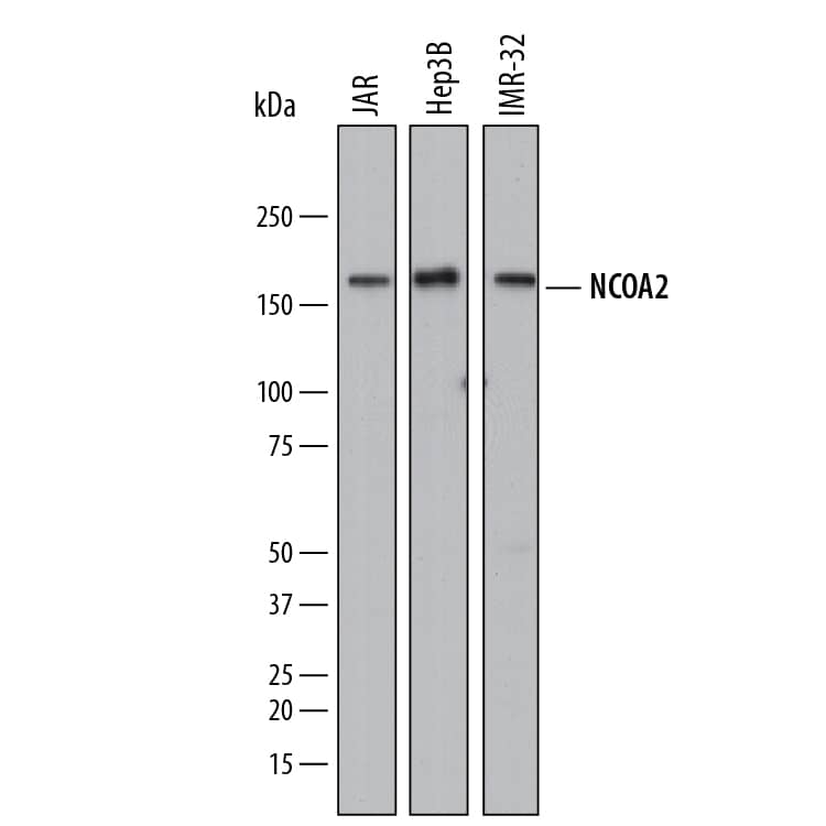 Western blot shows lysates of JAR human choriocarcinoma cell line, Hep3B human hepatocellular carcinoma cell line, and IMR-32 human neuroblastoma cell line. PVDF membrane was probed with 0.5 µg/mL of Sheep Anti-Human NCOA2 Antigen Affinity-purified Polyclonal Antibody (Catalog # AF8010) followed by HRP-conjugated Anti-Sheep IgG Secondary Antibody (Catalog # HAF016). A specific band was detected for NCOA2 at approximately 160 kDa (as indicated). This experiment was conducted under reducing conditions and using Immunoblot Buffer Group 1.