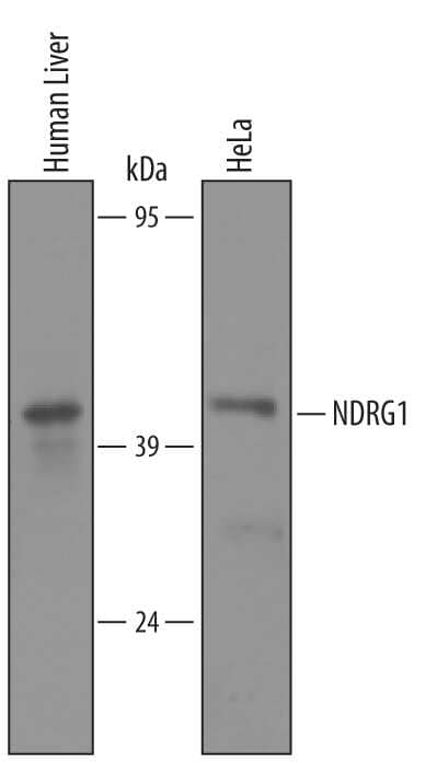 Western blot shows lysates of human liver tissue and HeLa human cervical epithelial carcinoma cell line. PVDF membrane was probed with 1 µg/mL of Goat Anti-Human NDRG1 Antigen Affinity-purified Polyclonal Antibody (Catalog # AF5209) followed by HRP-conjugated Anti-Goat IgG Secondary Antibody (Catalog # HAF019). A specific band was detected for NDRG1 at approximately 43 kDa (as indicated). This experiment was conducted under reducing conditions and using Immunoblot Buffer Group 8.