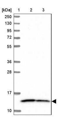 NDUFS5 Antibody (NBP2-13648): Novus Biologicals