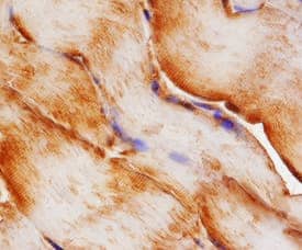 NEDD8 was detected in immersion fixed paraffin-embedded sections of human skeletal muscle using 15 µg/mL Sheep Anti-Human/Mouse/Rat NEDD8 Antigen Affinity-purified Polyclonal Antibody (Catalog # AF4936) overnight at 4 °C. Tissue was stained with the Anti-Sheep HRP-DAB Cell & Tissue Staining Kit (brown; Catalog # CTS019) and counterstained with hematoxylin (blue). View our protocol for Chromogenic IHC Staining of Paraffin-embedded Tissue Sections.