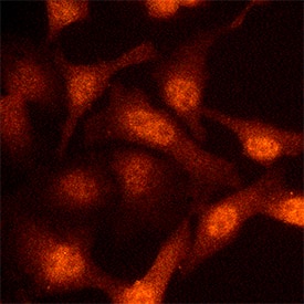 NEDD8 was detected in immersion fixed HeLa human cervical epithelial carcinoma cell line using Mouse Anti-Human/Mouse/Rat NEDD8 Polyclonal Antibody (Catalog # MAB49361) at 25 µg/mL for 3 hours at room temperature. Cells were stained using the NorthernLights™ 557-conjugated Anti-Mouse IgG Secondary Antibody (red; Catalog # NL007) and counterstained with DAPI (blue). Specific staining was localized to nuclei. View our protocol for Fluorescent ICC Staining of Cells on Coverslips.