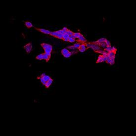 NELL1 was detected in immersion fixed IMR32 human neuroblastoma cell line using Mouse Anti-Human NELL1 Monoclonal Antibody (Catalog # MAB54871) at 10 µg/mL for 3 hours at room temperature. Cells were stained using the NorthernLights™ 557-conjugated Anti-Mouse IgG Secondary Antibody (red; Catalog # NL007) and counterstained with DAPI (blue). Specific staining was localized to cytoplasm. View our protocol for Fluorescent ICC Staining of Cells on Coverslips.