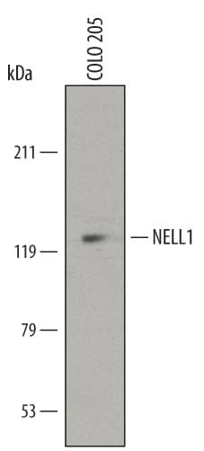 Western blot shows lysates of COLO 205 human colorectal adenocarcinoma cell line. PVDF membrane was probed with 2 µg/mL of Mouse Anti-Human NELL1 Monoclonal Antibody (Catalog # MAB5487) followed by HRP-conjugated Anti-Mouse IgG Secondary Antibody (Catalog # HAF007). A specific band was detected for NELL1 at approximately 140 kDa (as indicated). This experiment was conducted under reducing conditions and using Immunoblot Buffer Group 1.