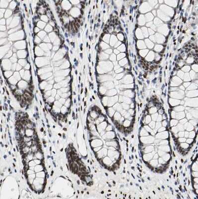 Immunohistochemistry-Paraffin: NFIA Antibody [NBP1-81406] - Staining of human gastrointestinal shows strong nuclear positivity in glandular cells.