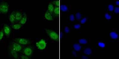Immunocytochemistry/Immunofluorescence: NFIC Antibody [NBP2-76954] -  ICC staining Nfic in SiHa cells (green). The nuclear counter stain is DAPI (blue). Cells were fixed in paraformaldehyde, permeabilised with 0.25% Triton X100/PBS.