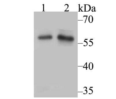 Western Blot: NFIC Antibody [NBP2-76954] - Western blot analysis of Nfic on different cell lysate using anti-Nfic antibody at 1/500 dilution.Positive control:Lane1: A549Lane2: SiHa