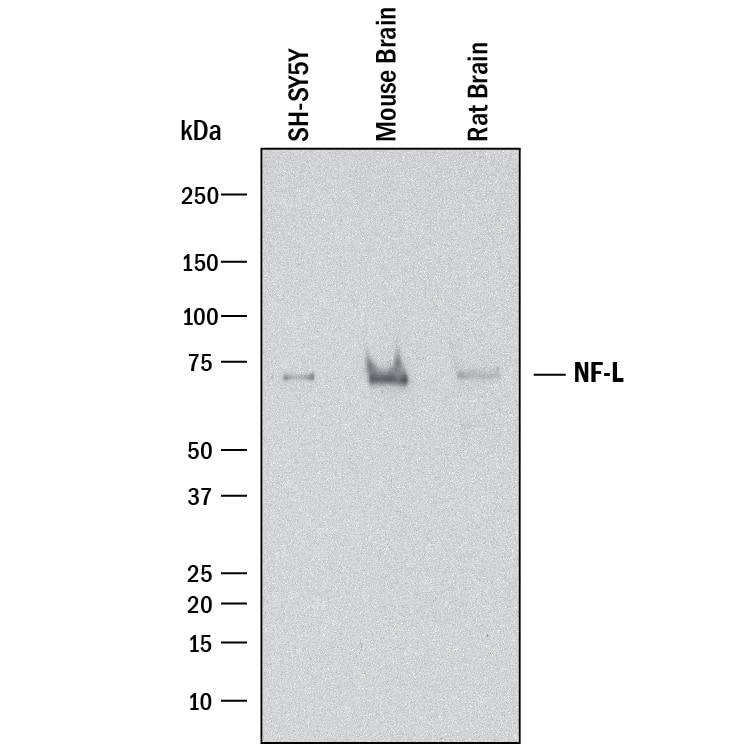 Western blot shows lysates of SH-SY5Y human neuroblastoma cell line, mouse brain tissue, and rat brain tissue. PVDF membrane was probed with 2 µg/mL of Mouse Anti-Human NF-L Monoclonal Antibody (Catalog # MAB22161) followed by HRP-conjugated Anti-Mouse IgG Secondary Antibody (HAF018). A specific band was detected for NF-L at approximately 70 kDa (as indicated). This experiment was conducted under reducing conditions and using Immunoblot Buffer Group 3.