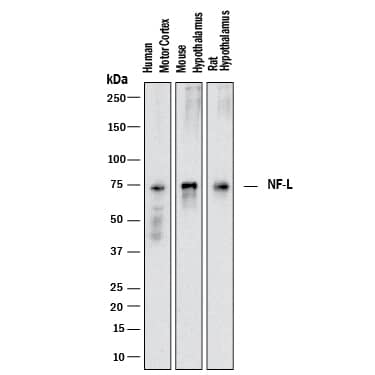 Western blot shows lysates of human motor cortex tissue, mouse hypothalamus tissue, and rat hypothalamus tissue. PVDF membrane was probed with 2 µg/mL of Mouse Anti-Human/Mouse/Rat NF-L Monoclonal Antibody (Catalog # MAB22163) followed by HRP-conjugated Anti-Mouse IgG Secondary Antibody (Catalog # HAF018). A specific band was detected for NF-L at approximately 68 kDa (as indicated). This experiment was conducted under reducing conditions and using Immunoblot Buffer Group 1.